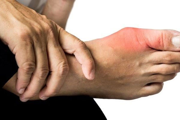 diet-for-people-with-gout-what-to-eat-what-to-abstain-to-treat-effectively-picture-1-RwxedzCrR.jpg